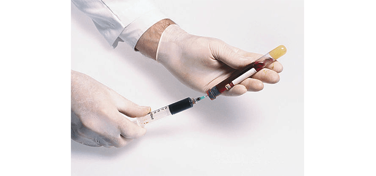Австралийского врача обвинили в заражении пациенток гепатитом С