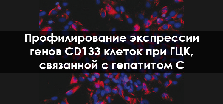 Профилирование экспрессии генов CD133 клеток при ГЦК