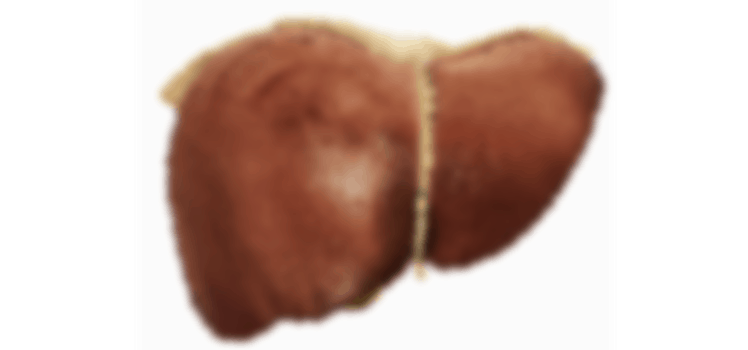 4 стадия фиброза печени при гепатите с лечится thumbnail