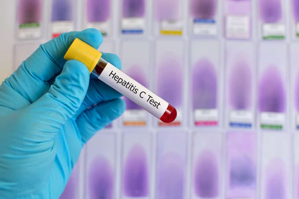 Анализ крови на маркеры вирусных гепатитов В и С