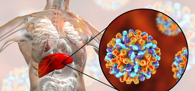 Хронический гепатит Б: можно ли вылечить?
