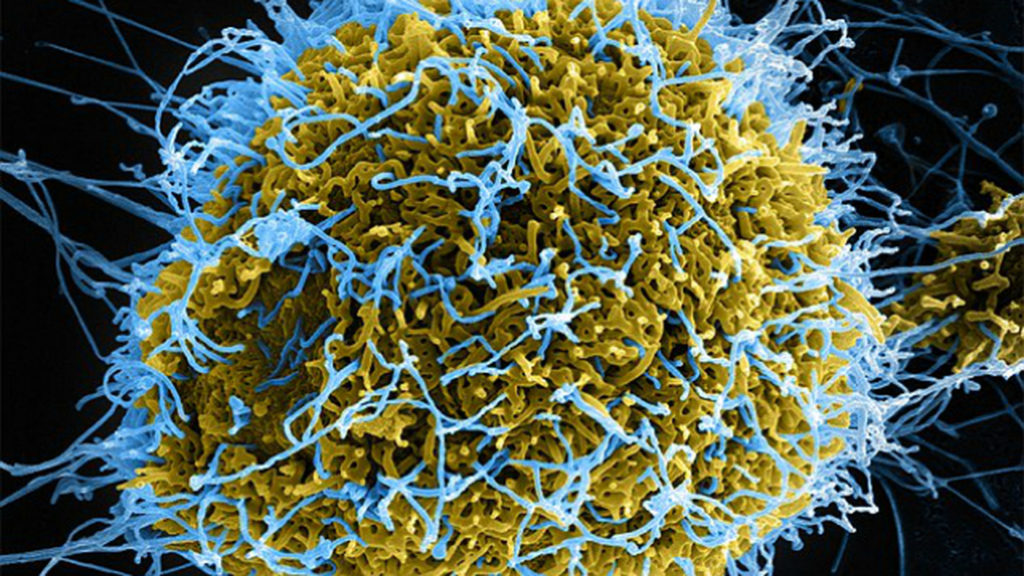 В Европе одобрили вакцину от эболы. Ее создавали 20 лет