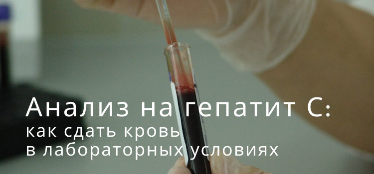 Анализ на гепатит С: как сдавать кровь в лабораторных условиях?