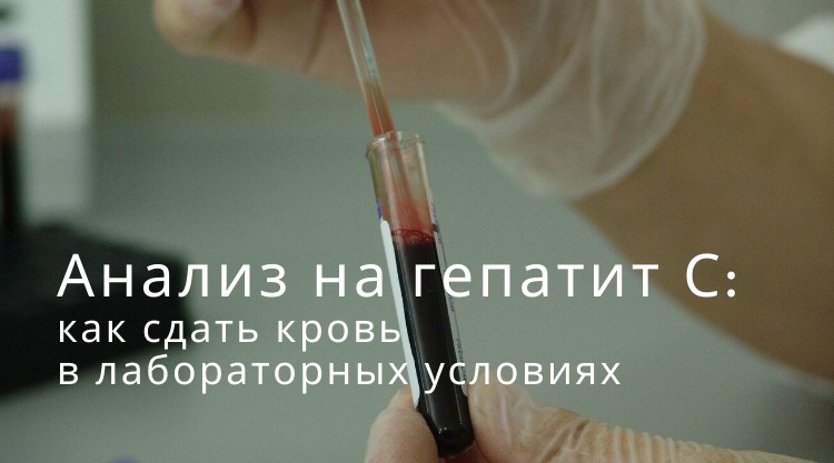 Анализ на гепатит С: как сдавать кровь в лабораторных условиях?