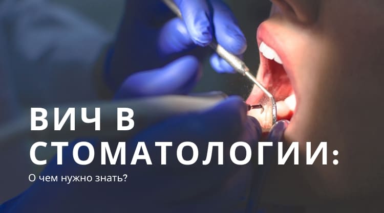 ВИЧ-инфекция в стоматологии: все, что нужно знать