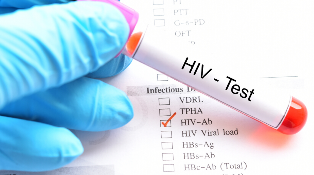 Диагностика ВИЧ-инфекции