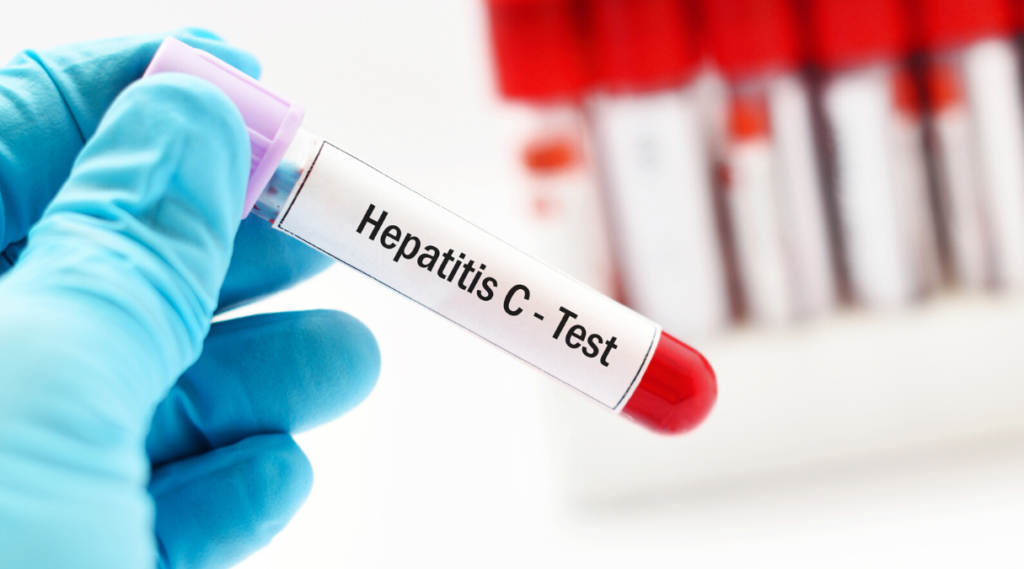Тест на гепатит 