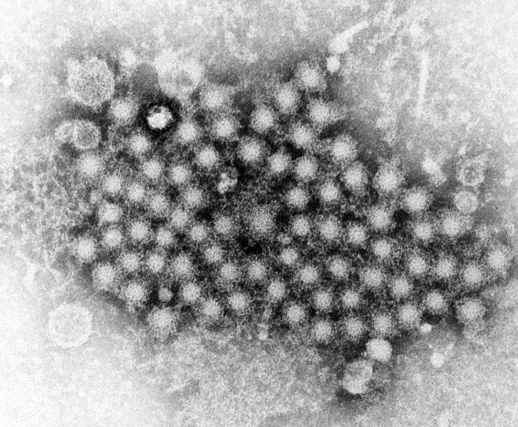 Вирус гепатита с