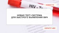 Новая тест-система для быстрого выявления ВИЧ