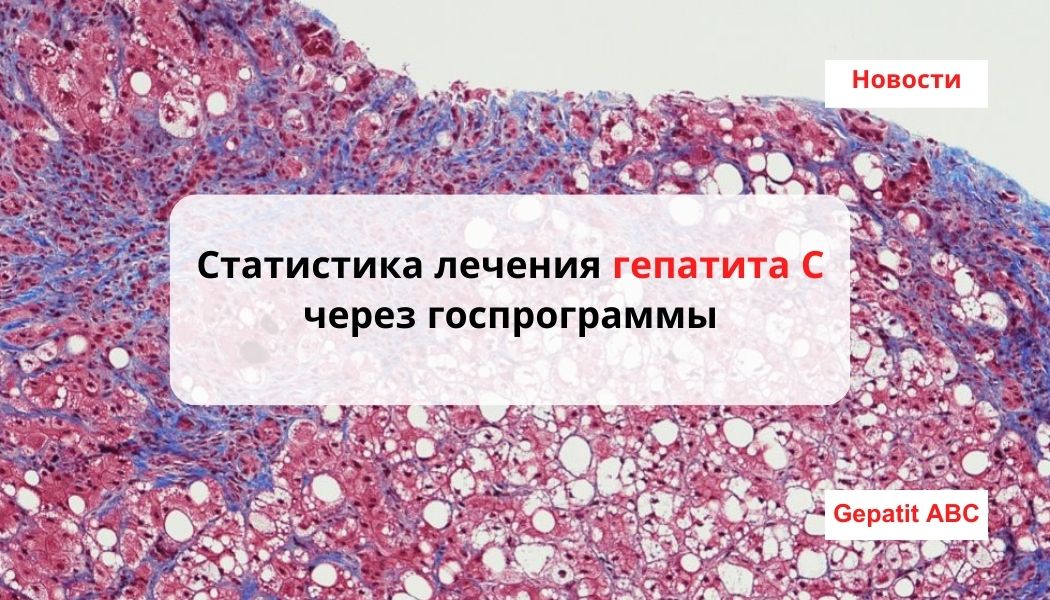 Hbc гепатит. Стоп гепатит. Агат для статистической терапии.