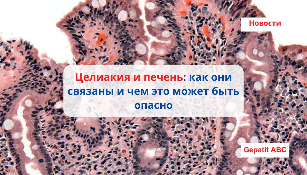 Целиакия и печень: как они связаны и чем это может быть опасно