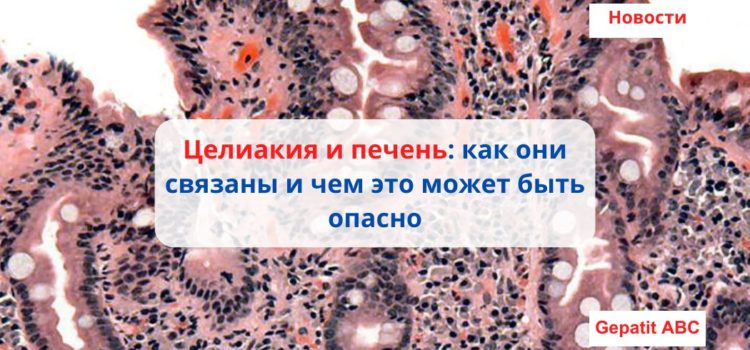 Целиакия и печень: как они связаны и чем это может быть опасно