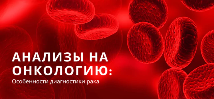 Что сдать, чтобы проверить себя на наличие рака?