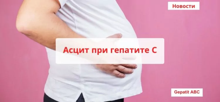 Асцит при гепатите С